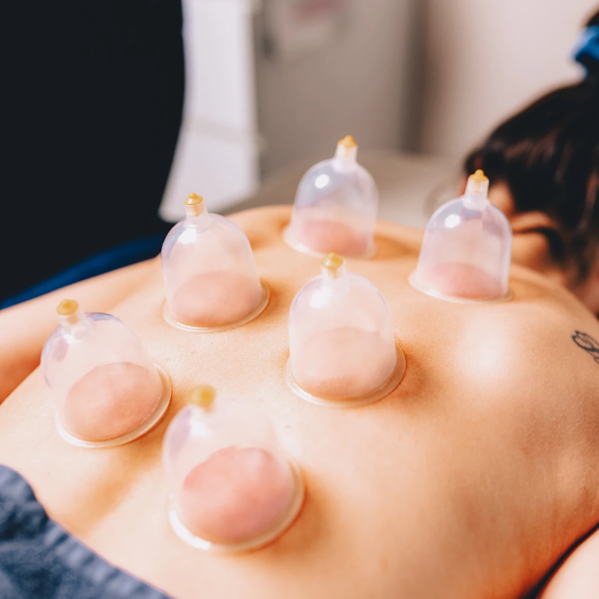 Cupping massage